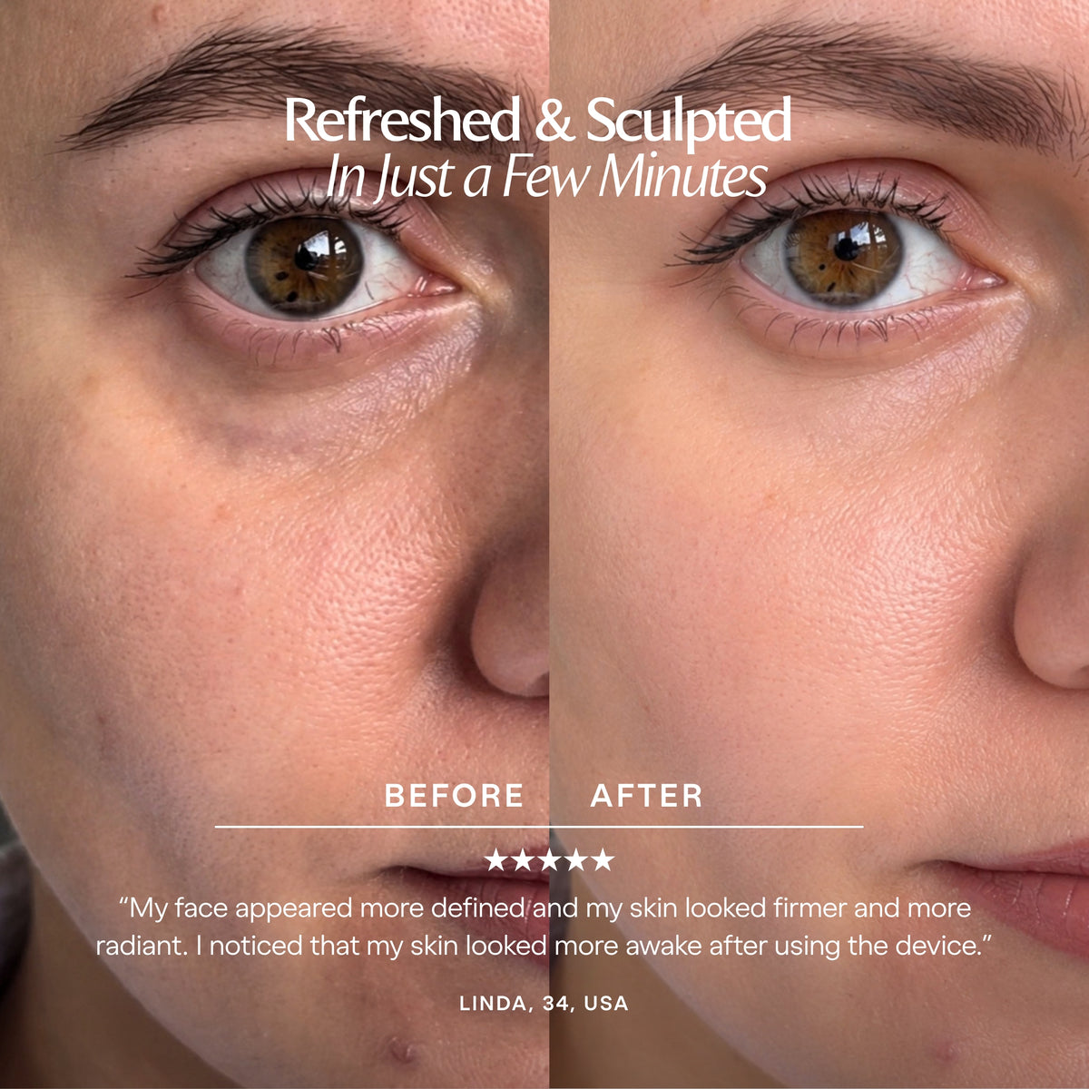 Cryo Ice Roller | Duo sculptant par le froid — Project E Beauty